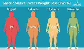 However, there are some simple ways to calculate the expected weight loss. How Much Weight Will I Lose With Gastric Sleeve Surgery Infographic
