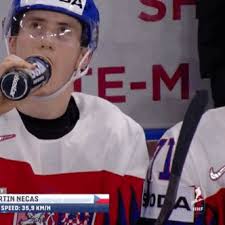 Krejci mentioned a kid who suffered from gingival (gum) swelling under one of his teeth. Simply Everything Czechs Just Dorking Around Ft Goalies Are A