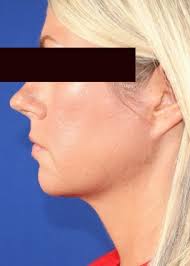 Cosmetic Surgery & Vein Treatment in Springfield, MO