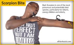 A scorpion's venom is a mixture of compounds, including neurotoxins that affect the victim's nervous system. Scorpion Bite Symptoms Gifs Get The Best Gif On Giphy