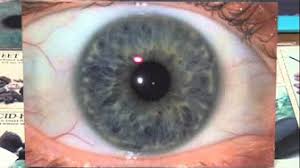 Iridology And Sclerology Youtube