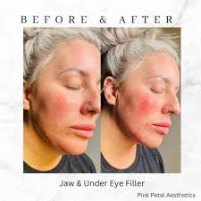 THE BEST 10 TATTOO REMOVAL in KNOXVILLE, TN