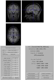 Check online, via sms, and at your school. 5 Miscellaneous Functions And Utilities This Section Describes Miscellaneous Functions And Utilities That Are Included With Spm 5 1 Display Interactive Orthogonal Display Of Selected Image Display Utilities Bottom Left Panel Image Intensity At Crosshair