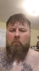 Weight Loss Journey with Portion Control and Simpich at 74 Years Old