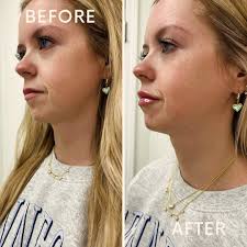 Valentines Day lips for this mama!! Come get yours for $100 off by February  14th💋