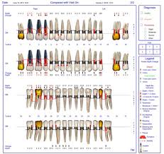 Improving Traditional Nonsurgical Methods For Peri Implant