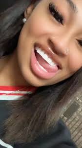 Forever Veneer Reviews Texas