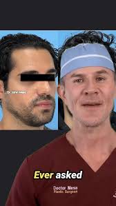 Can Buccal Fat Removal Fix a Chubby Smile and Asymmetrical Face?