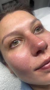 Lash Lift & Tint Service at Revive Skin Studio in Feasterville-Trevose, PA