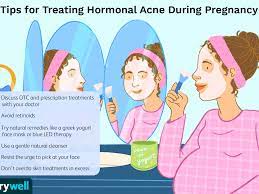 How To Deal With Hormonal Acne During Pregnancy
