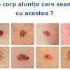 De cele mai multe ori ametelile nu au de ce sa te ingrijoreze, caci ele apar ca rezultat al schimbarii bruste a pozitiei capului sau a unei infectii virale in urechea interna ori o gripa sau raceala. 1