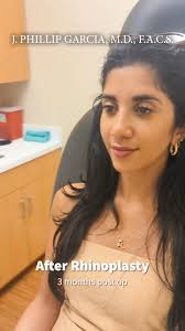 Garcia Facial Plastic Surgery