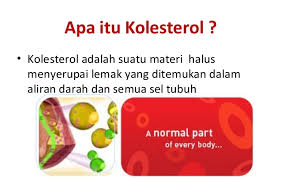 Kolesterol tinggi adalah kondisi di mana tingkat kolesterol dalam darah melampaui kadar normal sehingga dapat berpengaruh buruk bagi kesehatan. Turunkan Kolestrol Dengan Omega Guard Atau Phytocol St Pengedar Shaklee Shah Alam