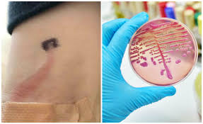 Zaharul le vine in fata casei, uleiul si painica la fel, ajutorul social tara de lenesi, ba! Pata Rosie Pe Mana Care Ii Putea Fi Fatala Copilului De 8 Ani