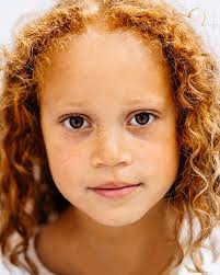 Mixed Race Black And Ginger Mixed Babies Mc1r Project By Michelle Marshall Tumblr For Redheads Red Hair Don T Care Redheads People With Red Hair