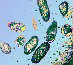 Image result for Rickettsiae