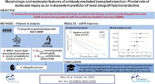 Image result for Transplant Rejection