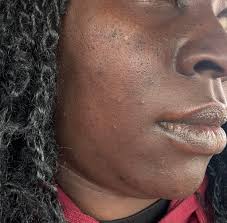 What do I need to clear my face?