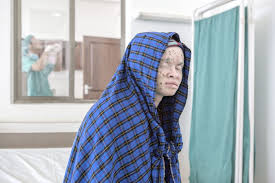 Skin cancer is by far the most common type of cancer. Skin Cancer Is The Most Common Cancer In Humans Beyond Suncare