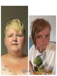 Fundraiser by Hannah Sleight : Raising money to help pay for my surgery