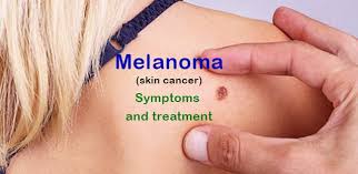 Melanoma is not as common as other types of skin cancer, but it's the most serious and potentially deadly. What Is Melanoma Symptoms And Treatment Of Skin Cancer