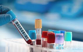 An antigen test, such as a test from a lateral flow device >>. Testes De Pesquisa De Antigenio Sns