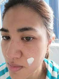 Nose pads for eyeglasses might seem subtle, but they actually go a long way in keeping your favorite frames on your nose. Indents From Wearing Glasses For Too Long Myglassesandme Eyewear Blog