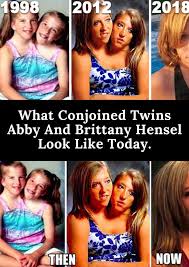You may have heard of abby and brittany hensel before, either on oprah, in time magazine, or on their tlc tv special. Abby And Brittany Hensel Restroom Abby And Brittany Hensel Conjoined 22 Year Old Twins Get