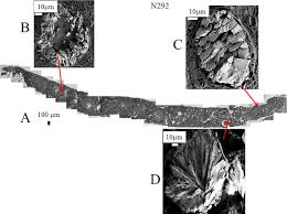 Elles sont presque toujours bénignes et n'impliquent aucune conséquence pour la santé. Calcification Medecine Wikipedia