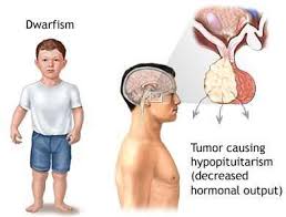 May 14, 2020 · adults who have a growth hormone deficiency — not the expected decline in growth hormone due to aging — might be prescribed synthetic hgh by their doctors. Growth Hormone Deficiency Symptoms Causes And Treatment Treat N Heal