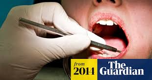 Get it as soon as thu, jul 1. No More Fillings As Dentists Reveal New Tooth Decay Treatment Health The Guardian