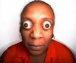 On This Day In Eyeball History The Longest Eyeball Pop Big Eyes Weird Cool Eyes