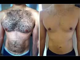 Then wait at least 10 minutes after using the best private parts hair removal. How To Remove Hair Permanently From Private Parts Naturally At Home Youtube