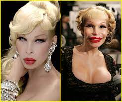 After years of fan requests. Amanda Lepore Plastic Surgery Before And After Prominente Plastische Chirurgie Plastische Chirurgie Amanda