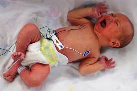 Rise In Opioid Exposed Newborns In Nj Prompts State Awareness Campaign Nj Spotlight News