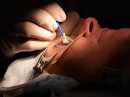 Nach einem ersten kurzcheck ist eine komplette augenärztliche untersuchung notwendig. Augen Lasern Scharf Sehen Ohne Brille Und Kontaktlinsen Gesundheit