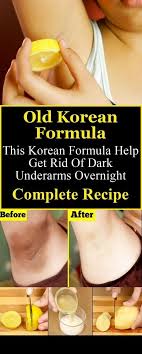 Old Korean Formula This Korean Formula Help Get Rid Of Dark Underarms Overnight Complete Recipe Natural Remedy Dark Underarms Dark Armpits Natural Skin Care