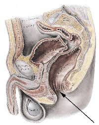 Hvis blodet er blandet inn i. Fakta Om Hemorroider Nettdoktor
