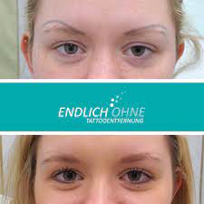Durch Die Endlich Ohne Permanent Make Up Entfernung Konnt Auch Ihr Eure Naturliche Lippen Permanent Make Up Augenbrauen Entfernen Permanent Make Up Augenbrauen