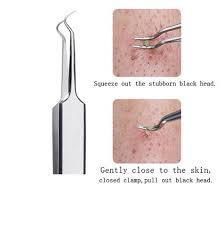A blackhead removal tool, or a sterilized comedone extractor, can be used to treat a patient who has a combination of dirt, oil and debris clogging their por. Instructions For Using Our Blackhead Extractor Set Properly