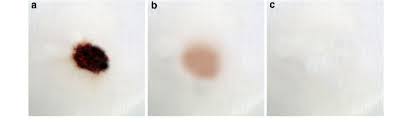 When you bring it to me. Blood Stain Removal Analysis Of Enzyme Preparation Unwashed Stained Download Scientific Diagram