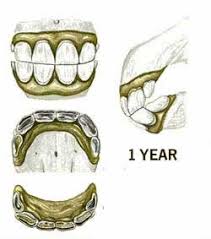 Horses Age From Teeth Growth Knowing The Signs Of Age