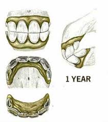 horses age from teeth growth knowing the signs of age