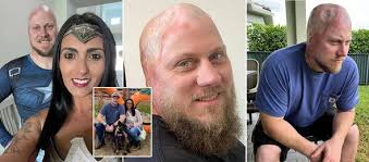 Man electrocuted by 4,160 volts saw 'skin melt' as wife had to burn him to  help recover