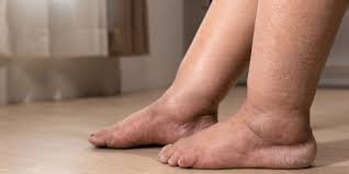 Image result for Pigment stains on the shin