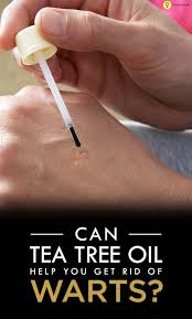 Pin On Essential Oils
