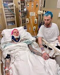 The draft system is designed like a large shock absorber to accept the impact of car movement without resulting in equipment or lading damage. Jeffree Star Hospitalized After Severe Car Accident People Com