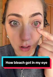 How Bleach Accidentally Got in My Eye