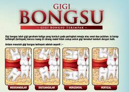 Gigi bongsu geraham saya terpaksa cabut atas sebab karies dan berlubang besar. Gigi Bongsu Senget