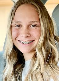 Swimming: Seven Dolphins win events at West Fargo meet